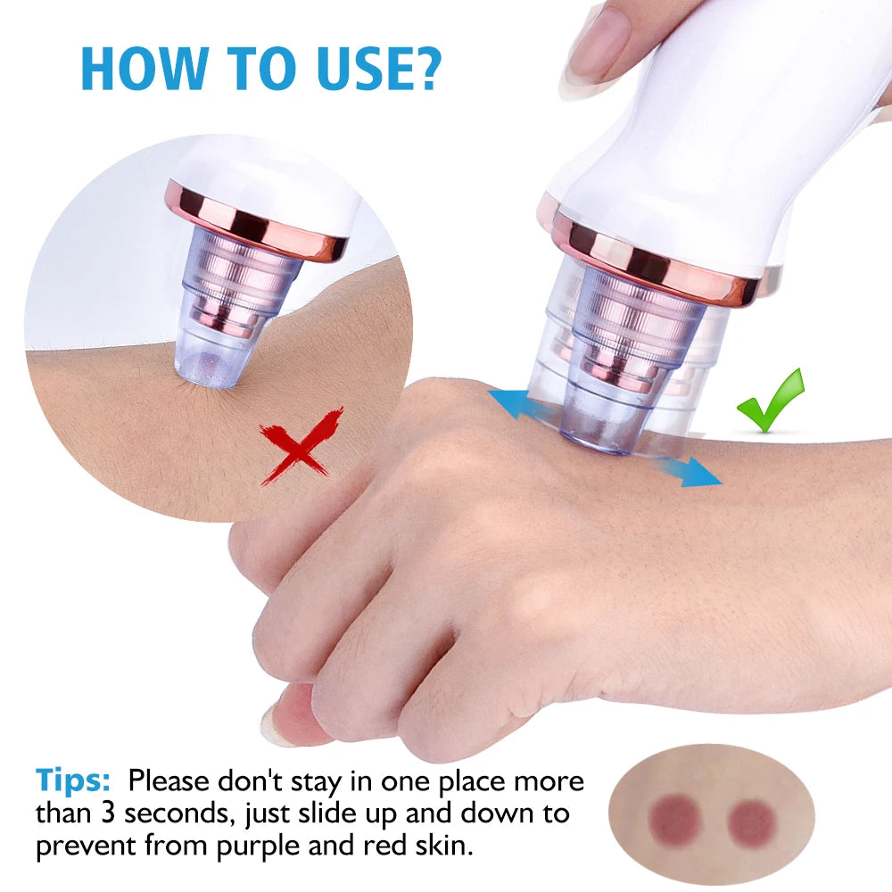 Élimination électrique des points noirs sous vide, nettoyage du visage des taches noires, aspiration des boutons d'acné, Instrument de beauté, outils de soins de la peau